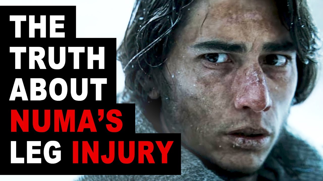 Numa Turcatti's Leg Injury Didn't Happen That Way | The Real Story | Society of the Snow