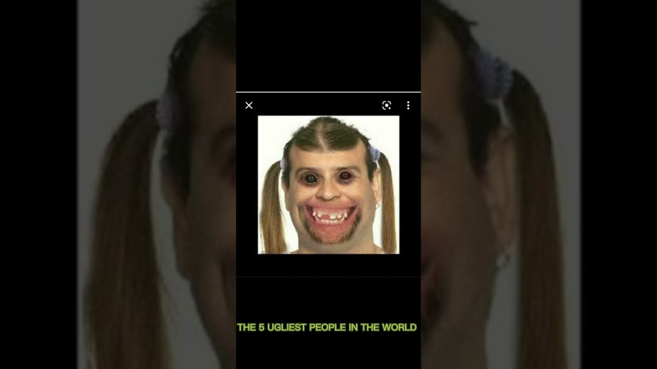 THE 5 UGLIEST PEOPLE IN THE WORLD