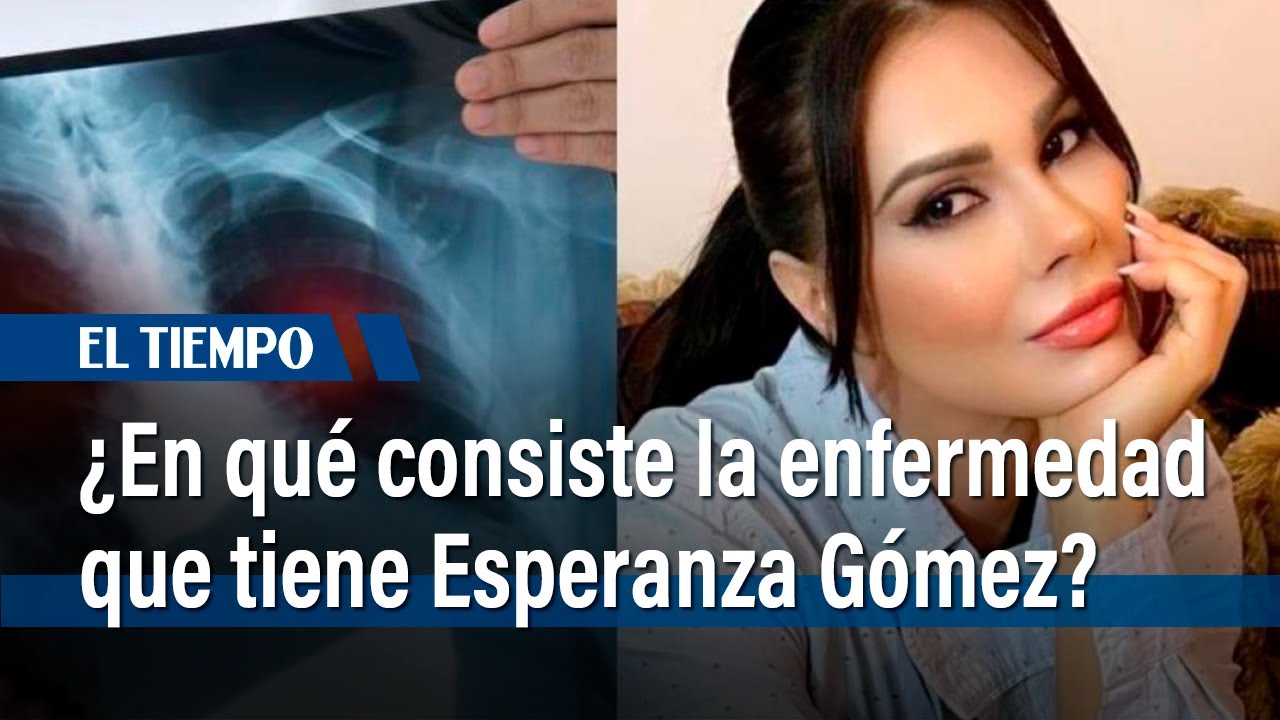 Esperanza Gómez: ¿En qué consiste la enfermedad que la tiene al borde del retiro?